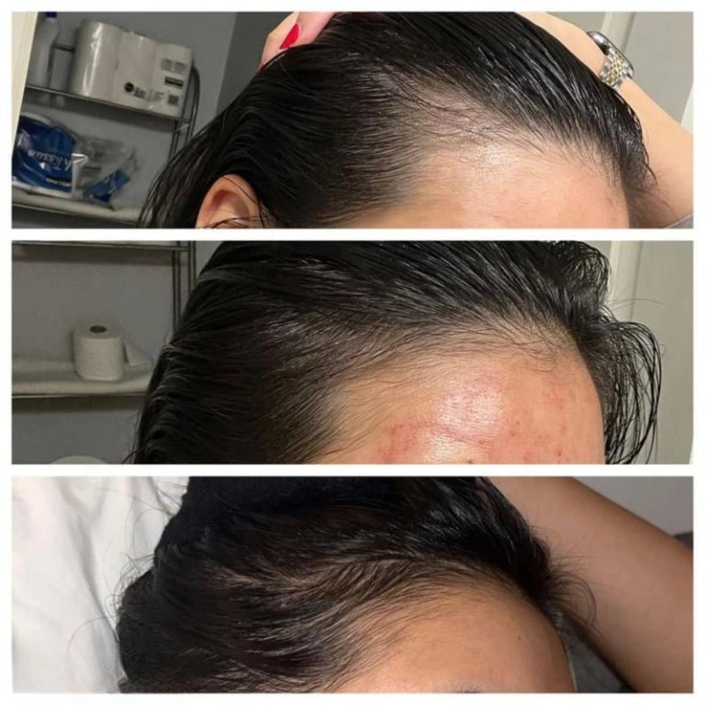 Capiluxe® – Suero Multipéptido para Densidad Capilar