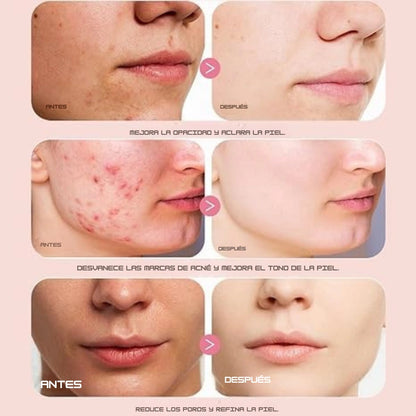 Anua Peach Glow® | Ilumina, Hidrata y Unifica tu Piel